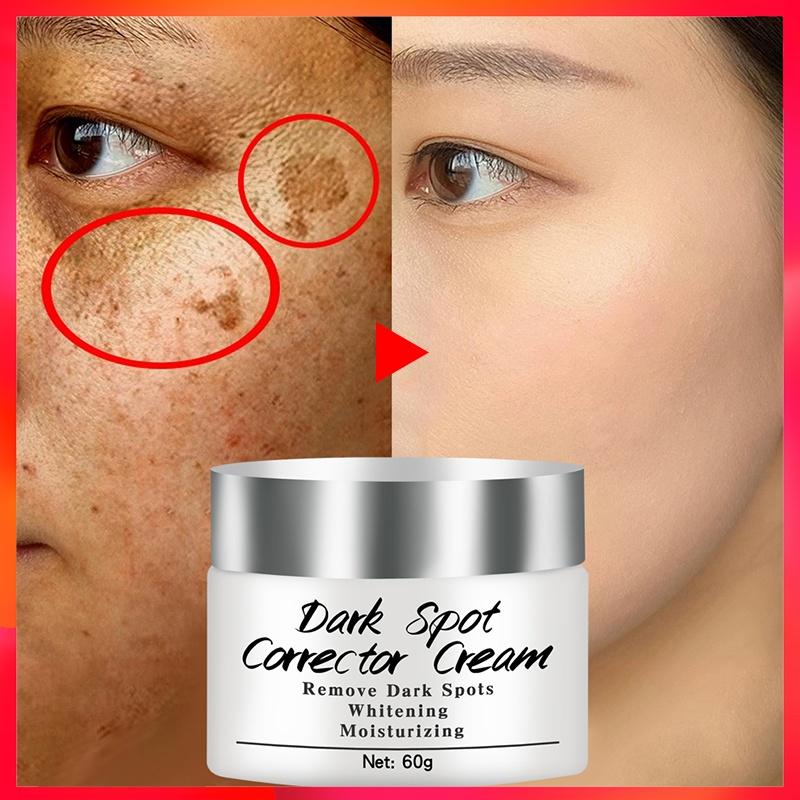 Best of Newest Dark Spots Corrector Cream Whitening Facial Cream Repair Fade Freckles Remove Dark Spots Melanin Reviews & Tips