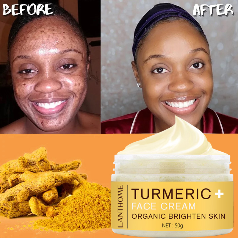 Best of 50g Turmeric Face Cream Reviews & Tips