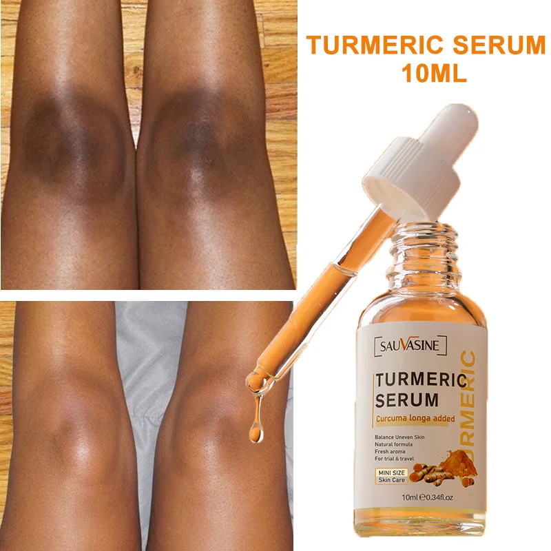 Best of Turmeric Serum Freckle Whitening Fade Dark Spots Removal Pigment Melanin Correcting Facial Beauty Face Skin Care Products 10ml Reviews & Tips