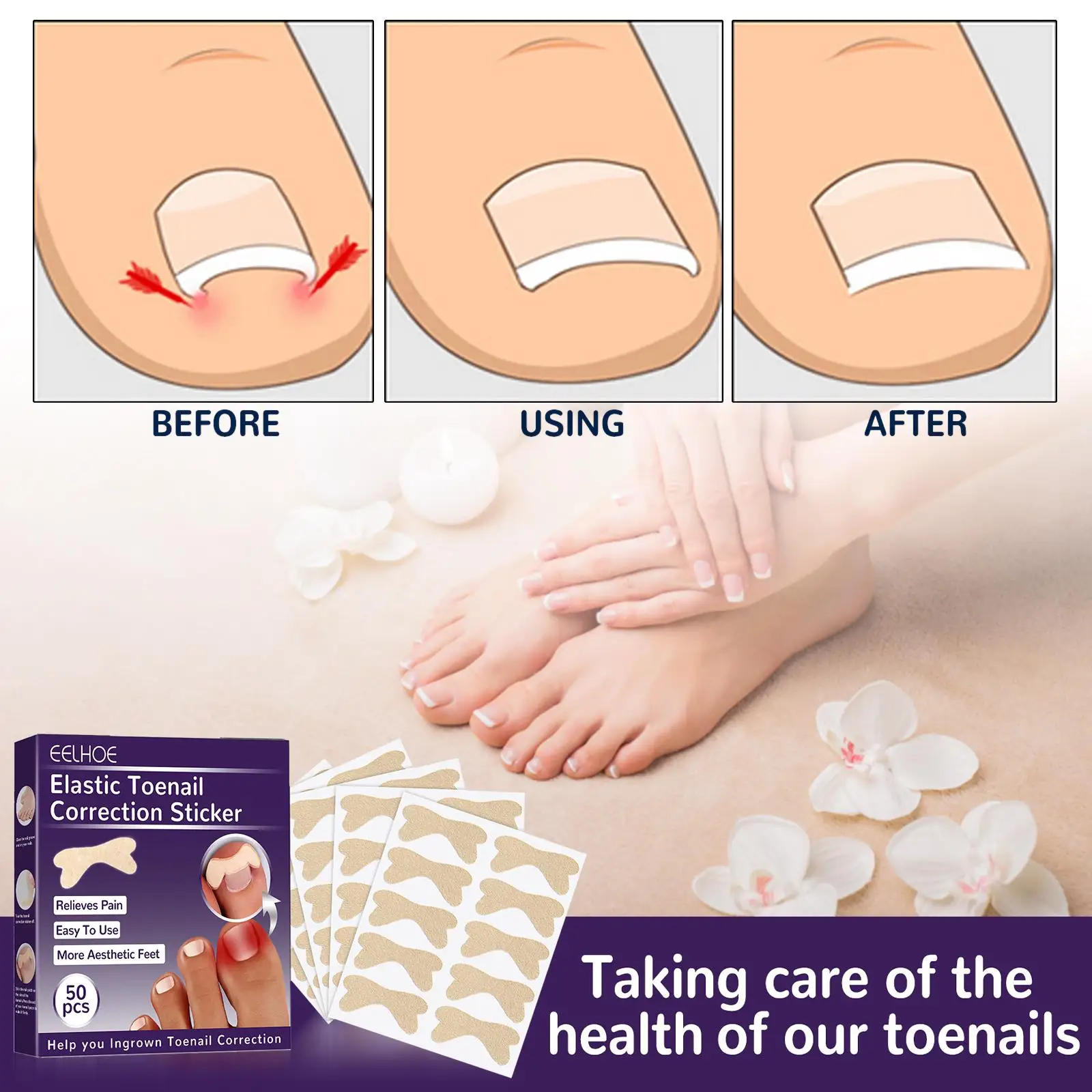 50x Toenail Patch Glue Free Toenail Care Tool Toenail Corrector Patches for Toe Nail Men