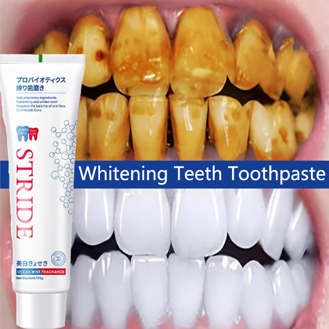 Best of Whitening Teeth Toothpaste Dental Calculus Remover Plaque Remover Fresh Breath Brightening Preventing Periodontitis Dental Care Reviews & Tips