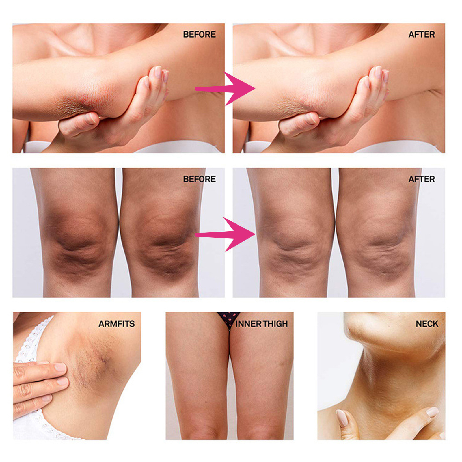 Crema schiarente per il corpo Originale Parti intime Ascelle Zona intima Correttore macchie scure Ginocchio Opacità Pelle Schiarente Crema sbiancante_voghion.com