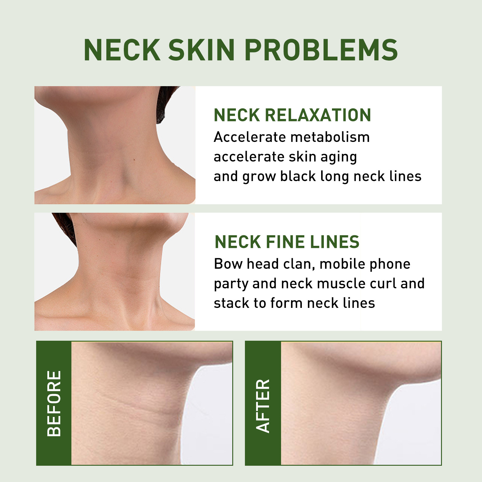 Neck Cream Firming Anti Wrinkle Tightening Remove Dark Spot Rejuvenation Skin Whitening Moisturizing Lines Gone Neck Gel Female_voghion.com