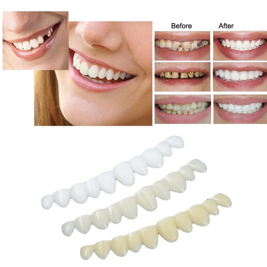 Best of Instant Smile Multi-Shade Temporary Tooth Replacement Kit TEMP KIT For Missing Tooth Reviews & Tips