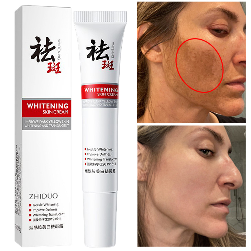 Best of Effective Whitening Freckles Cream Remove Dark Spots Fade Melanin Anti-Pigmentation Improve Dullness Fast Brighten Skin Care Reviews & Tips