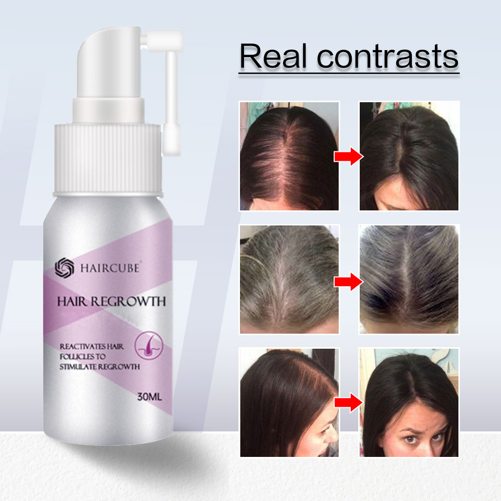 Best of Hair Growth Spray Fast Hair Grow Essential Oil For Men / Women Hair Care Products Anti Hair Loss Treatment Beauty Scalp Treatment Reviews & Tips