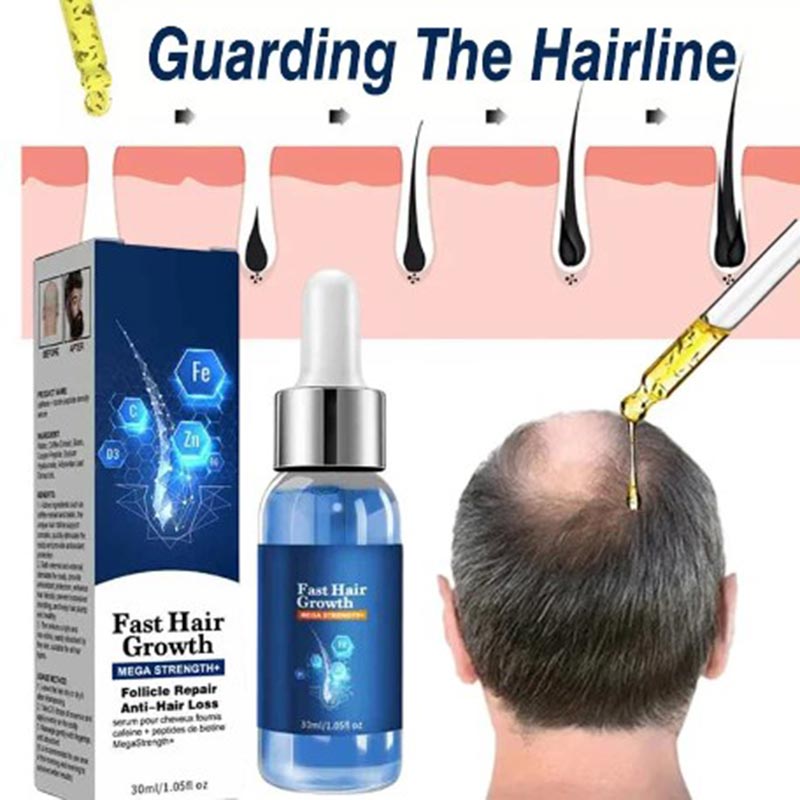 Best of Fast Hair Growth Hair Growth Oil Effective Baldness Repair Hereditary Hair Loss Postpartum Hair Loss Seborrheic Hair Anti Loss Reviews & Tips