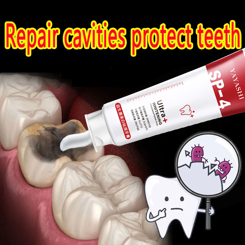 Best of Repair Of Cavities Caries Removal Of Plaque Stains Decay Whitening Yellowing Repair Teeth Whitening 2023 New Toothpaste 120g Reviews & Tips