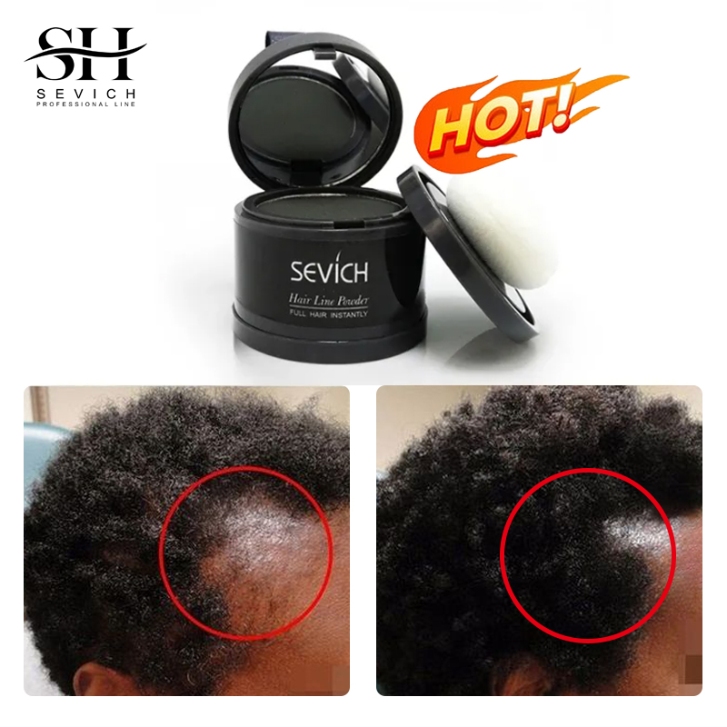 Best of Sevich Waterproof Hair Line Powder 4g Natural Instant Hairline Shadow Powder Black Root Cover Up Forehead Hair Makeup Concealer Reviews & Tips