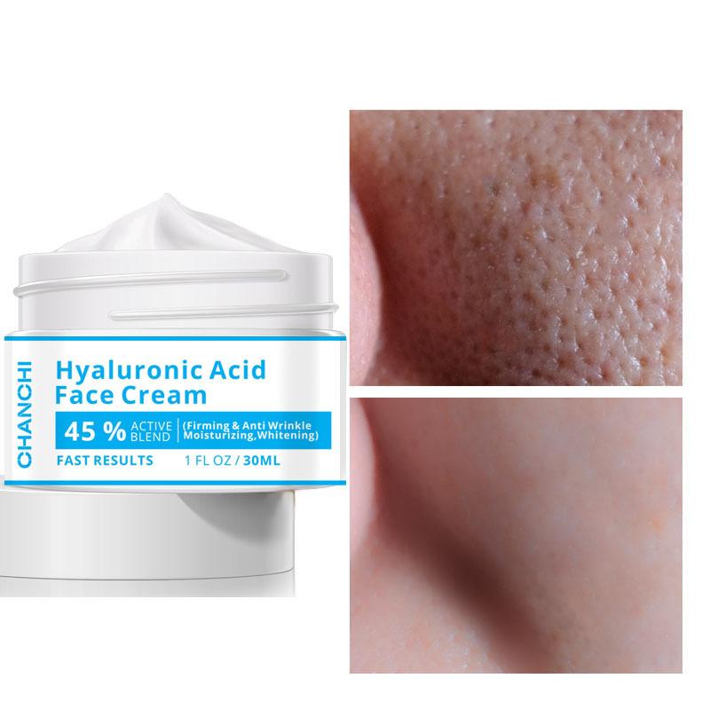 Best of Hyaluronic Acid Cream To Lighten Acne Marks Skin Care Firming Skin Tightening Cream Reviews & Tips