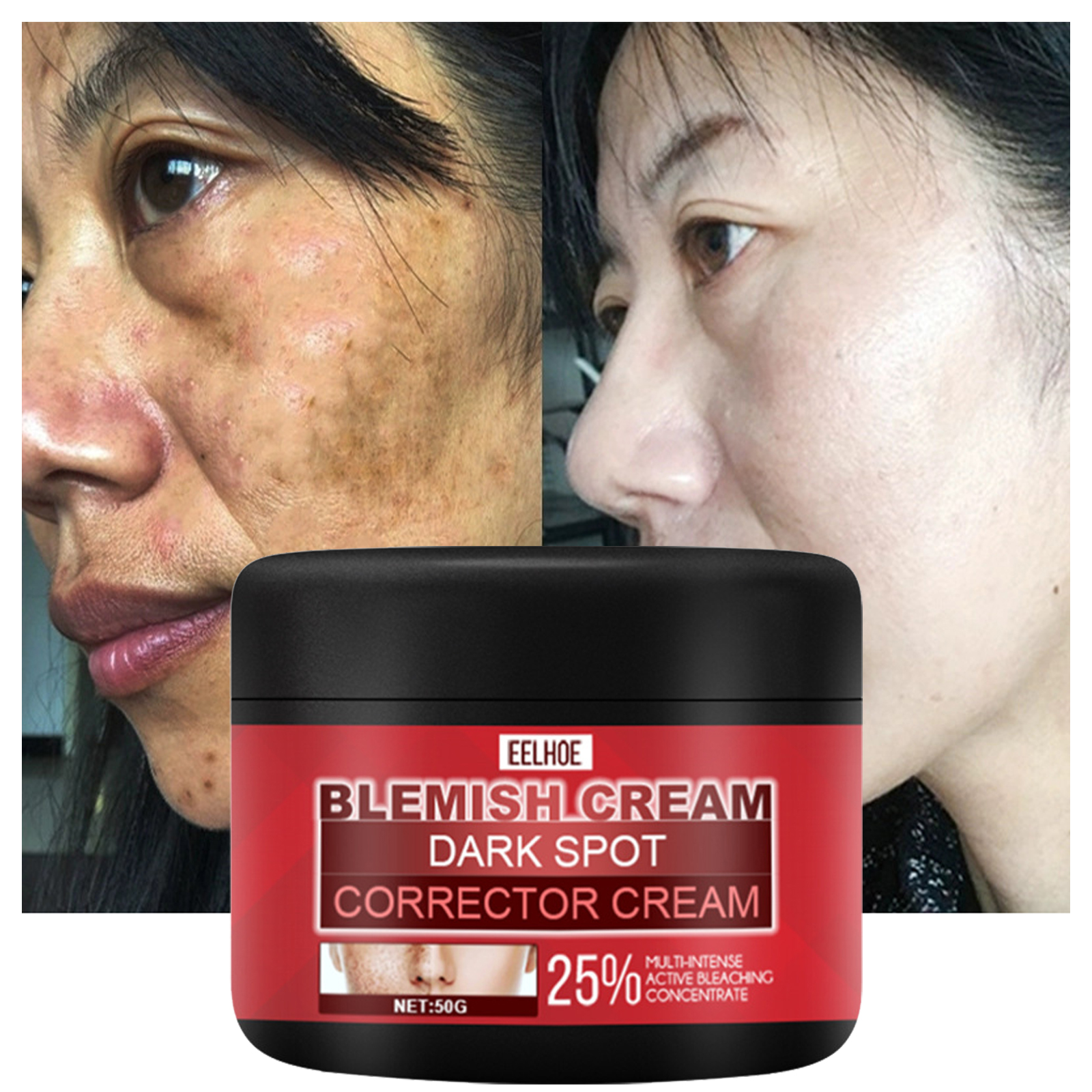 Best of Freckle Whitening Cream Remove Fade Dark Spots Pigment Melanin Fade Blemish Firming Brightening Moisturizing Facial Care 50g Reviews & Tips