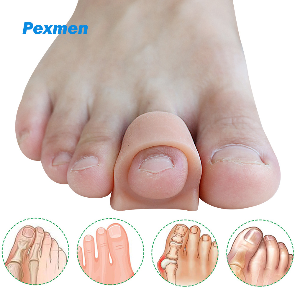 Best of Pexmen 2 / 4Pcs Soft Gel Big Toe Separator For Overlapping Toes Bunions Big Toe Alignment Corrector And Spacer Foot Protector Reviews & Tips