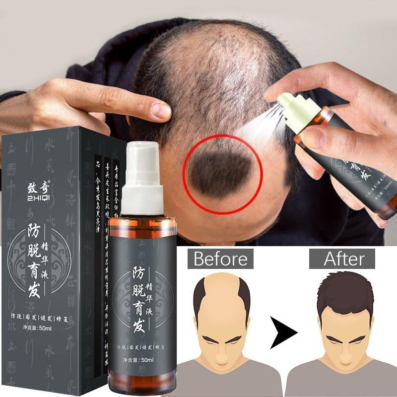 Best of 2022 Fast Hair Growth Serum Hair Tonic For Men &Women Hair Growth Anti Hair Fall Hair Loss Serum Hair Thinning Treatmen Reviews & Tips