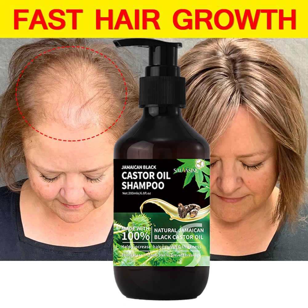 Best of 200ML Hair Growth Shampoo Jamaican Castor Oil Shampoo Quickly Strengthen Hair Roots Anti Hair Loss Products For Men For Women Reviews & Tips