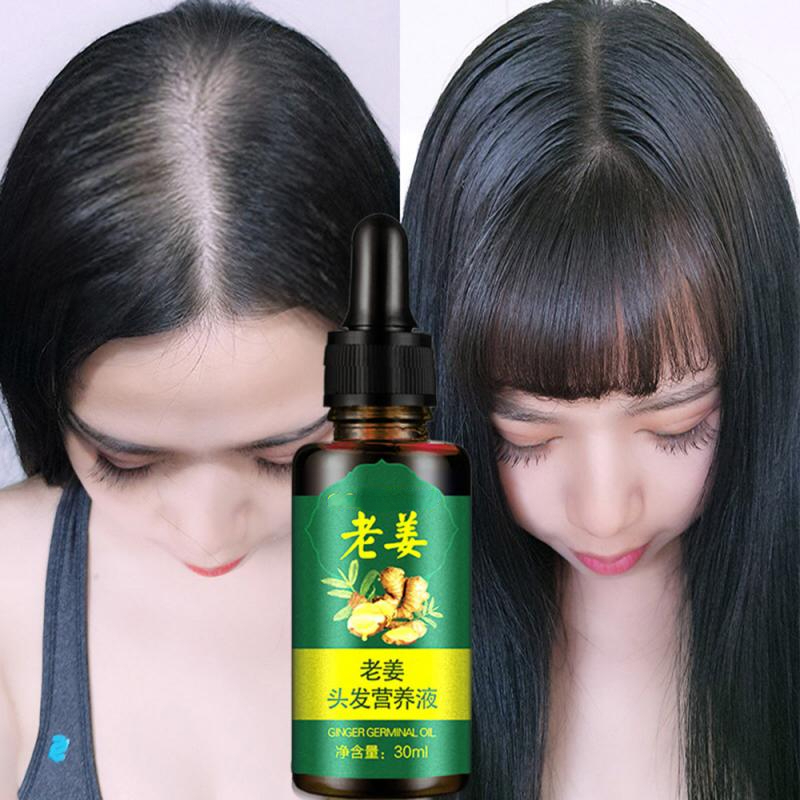 Best of Effective Ginger Hair Growth Ointment Hair Care Healthy Anti-Hair Loss Essence Oil Damaged Hair Nutrition Cream Reviews & Tips