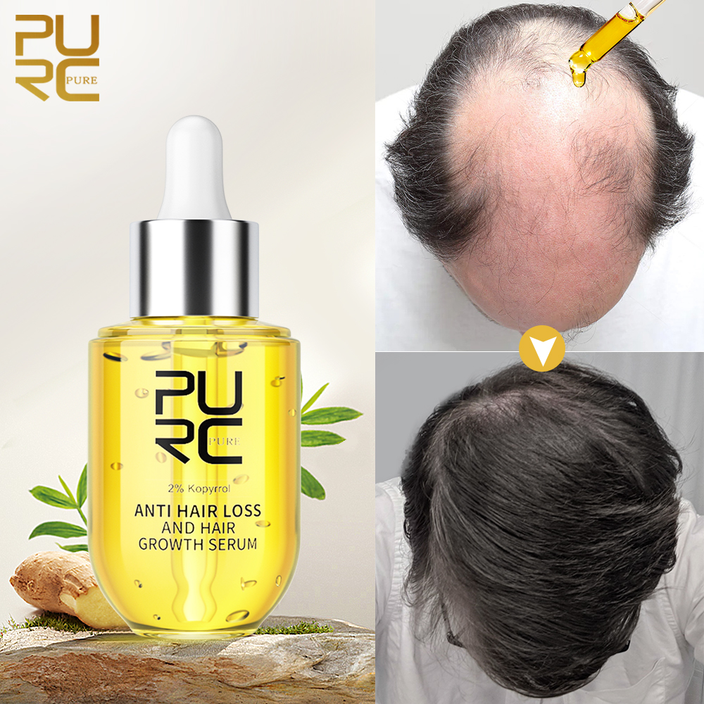 Best of PURC Biotin Hair Growth Products For Men Hair Loss Treatment Serum Ginger Fast Hair Regrowth Hair Care Reviews & Tips