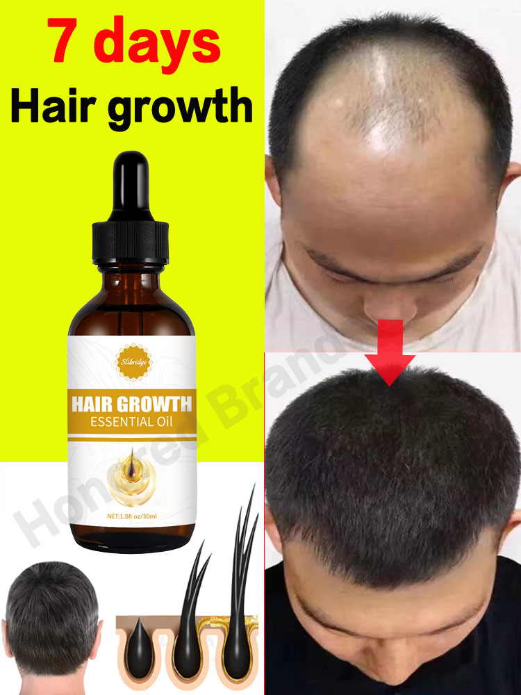 Best of Hair Growth Oil For Man Woman Fast Anti Hair Loss Products Reviews & Tips