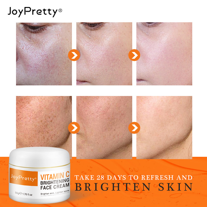 Best of JoyPretty Vitamin C Face Whitening Cream VC Acne Pimple Mark Removal Dark Spots Facial Creams Moisturizing Cream Skin Care 50ml Reviews & Tips - Image 3