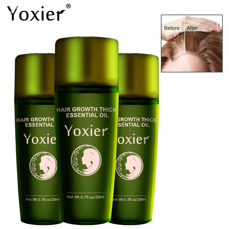 Best of Yoxier 3Pcs Hair Growth Essence Oil Effective Extract Anti Nourish Hair Roots Treatment Preventing Hair Loss Hair Care Products Reviews & Tips