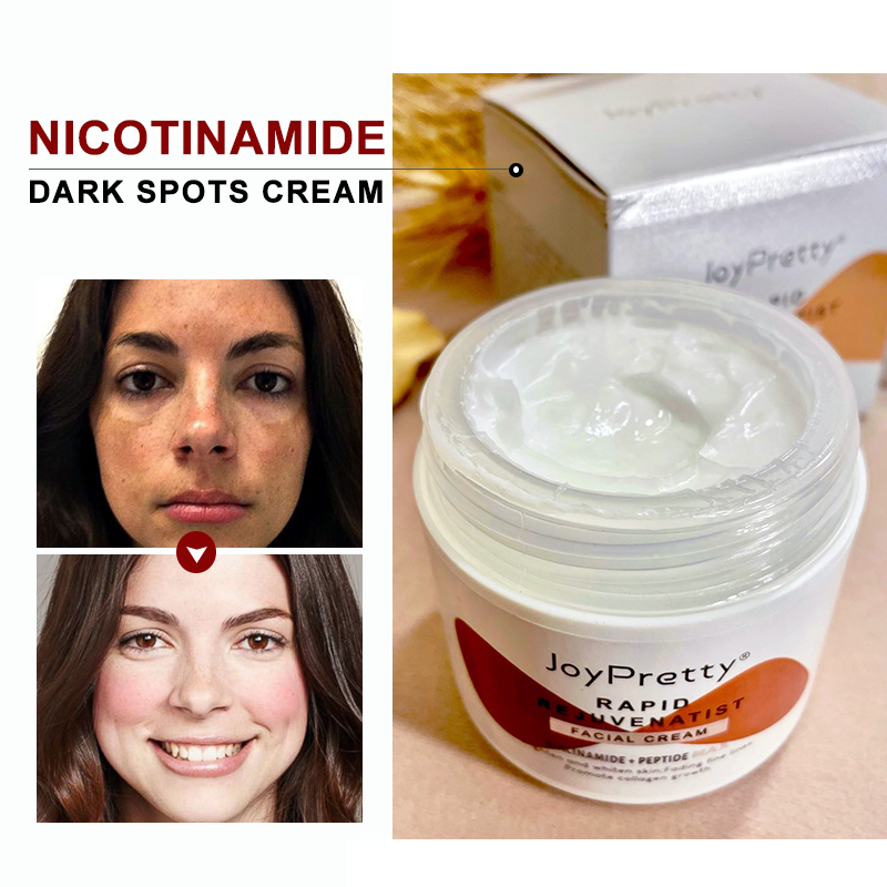 Best of Niacinamide Dark Spots Remove Cream Whitening Skin Care High Quality Face Cream Eliminate Facial Blemishes Moisturizing Creams Reviews & Tips