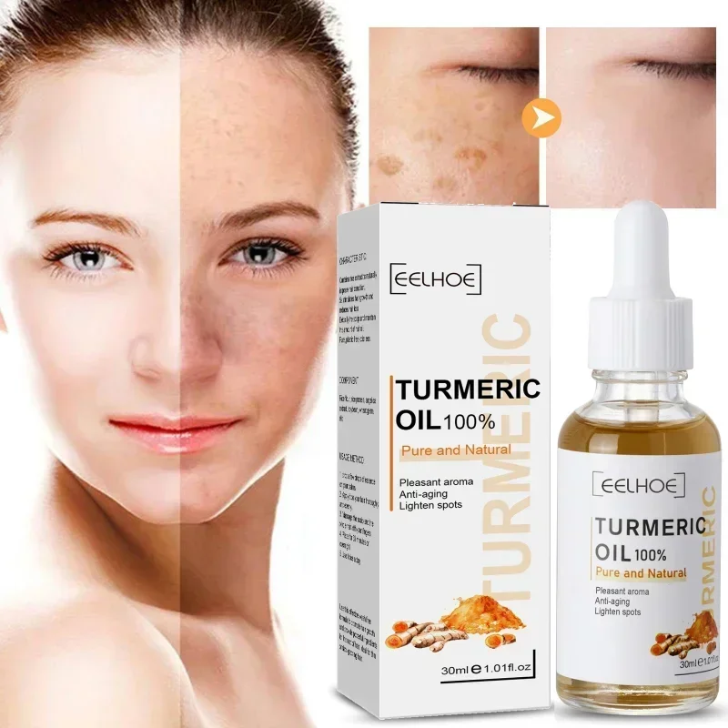 Best of Turmeric Freckle Whitening Serum Curcumin Oil Face Brighten Moisturizing Fade Dark Spot Removal Pigment Melaninskin Care Product Reviews & Tips