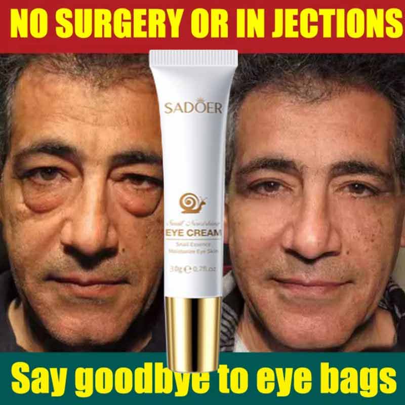 Best of Instant Eye Cream For Anti Aging Dark Circles Bags Puffiness Great Under Eye Skin Face Tightening Eye Lift Treatment Care Reviews & Tips