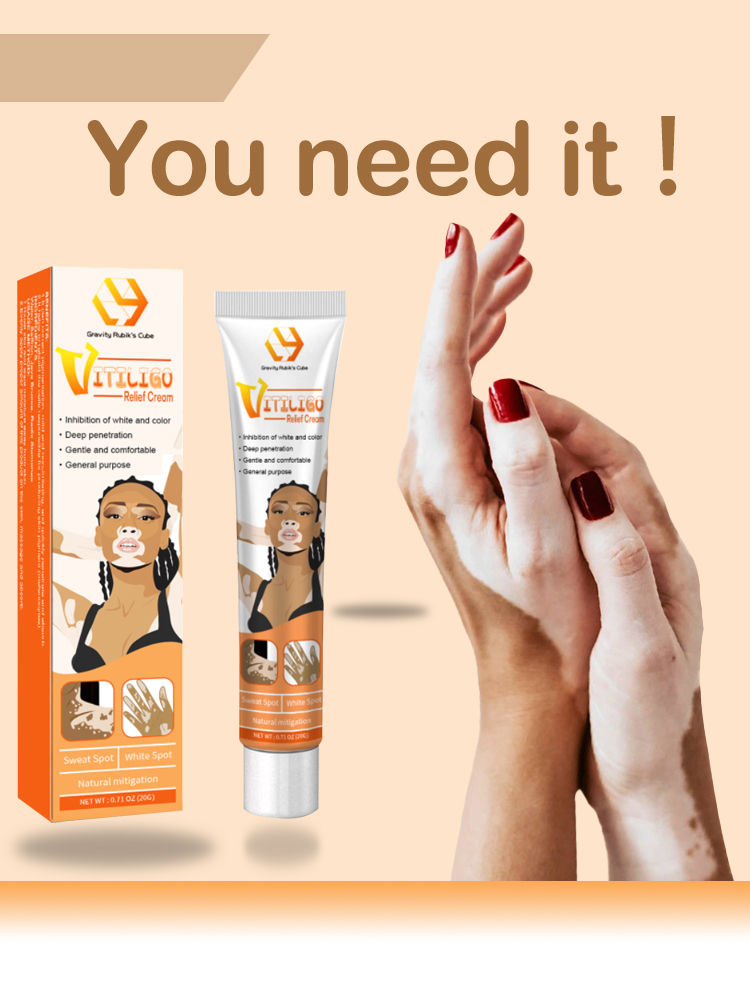 Best of Vitiligo Repair Cream Eliminate Skin White Spot Reviews & Tips