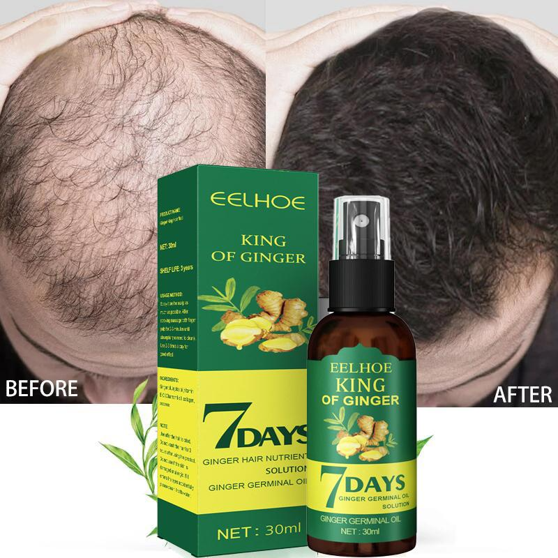 Best of 5 / 15 / 30 / 50ml Hair Growth Essential Oil Products Effective Fast Growing Serum Prevent Hair Loss Scalp Treatment For Men Women Reviews & Tips