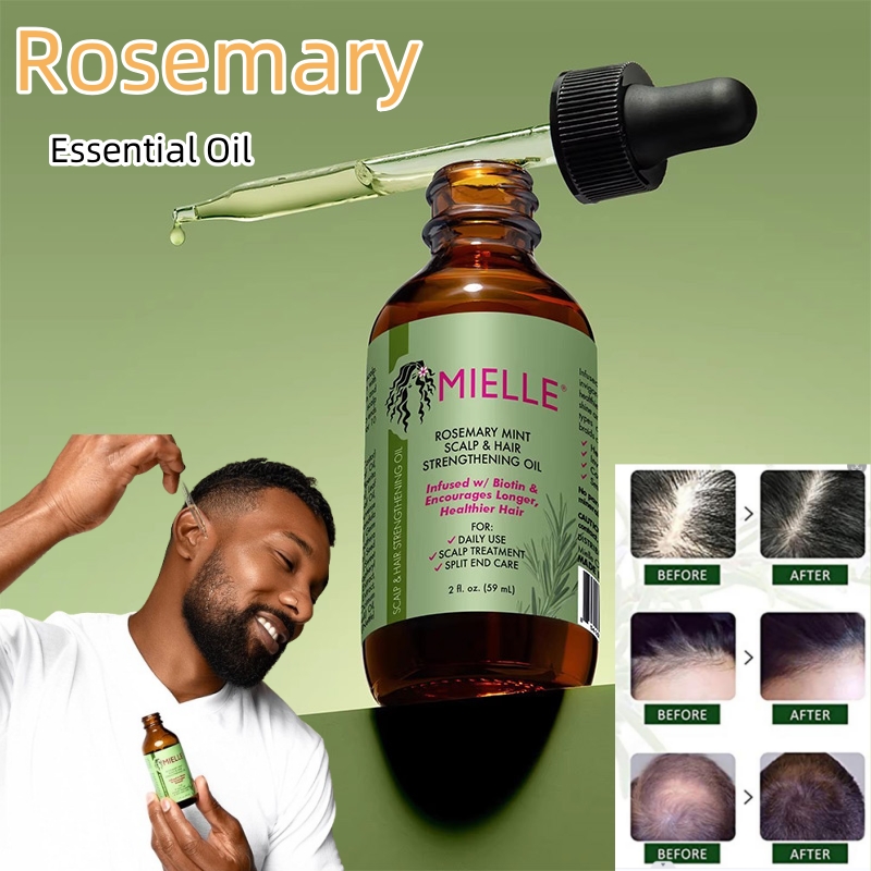 Best of Mielle Rosemary Hair Growth Essential Oil Mint Nourishing Treatment For Split Ends And Dry Organics Hair Loss Treatment Healthy Reviews & Tips