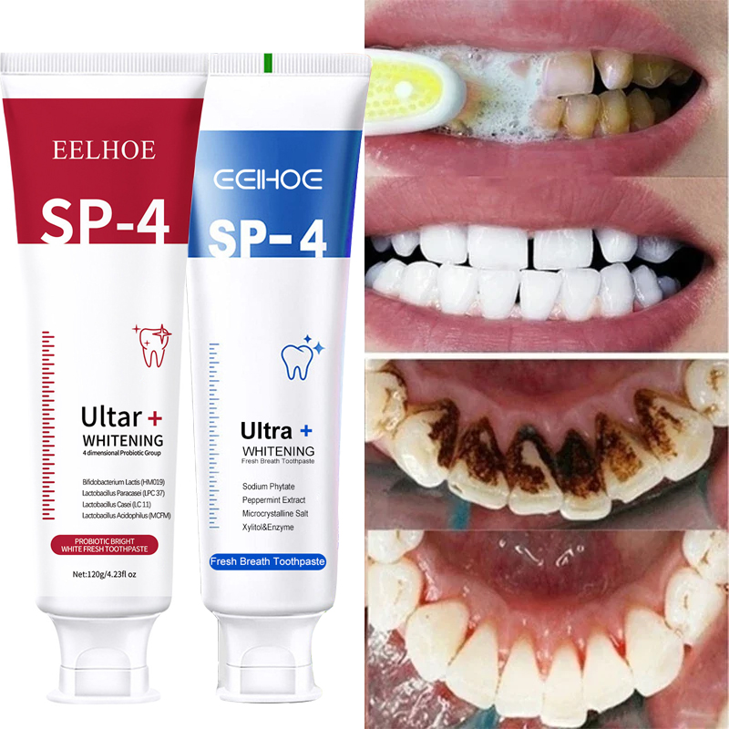 Best of 120g Probiotic Toothpaste SP-4 Whitening Tooth Remove Plaque Stains Teeth Whitener Oral Hygiene Clean Fresh Breath Dental Tools Reviews & Tips