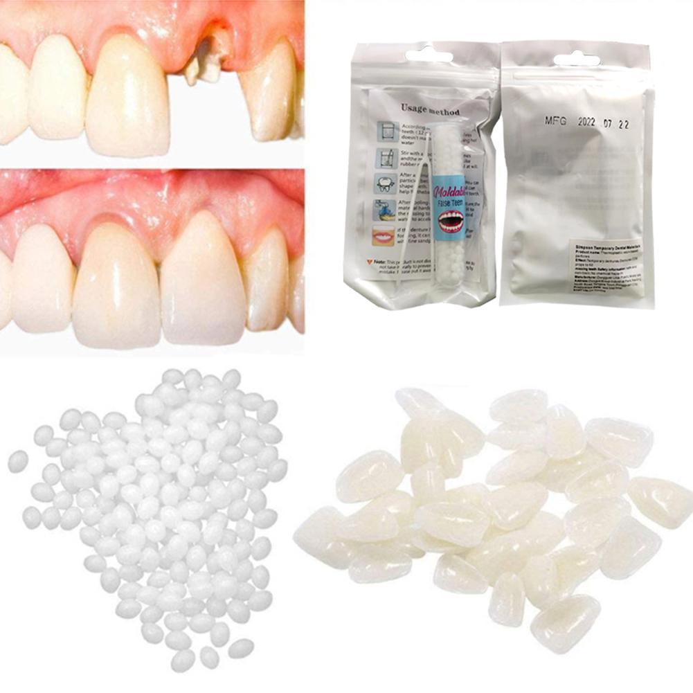 Best of 5g / 10g / 15g / 20g Temporary Tooth Repair Kit Teeth And Gaps False Teeth Solid Glue Denture Adhesive Teeth Whitening Tooth Beauty To Reviews & Tips