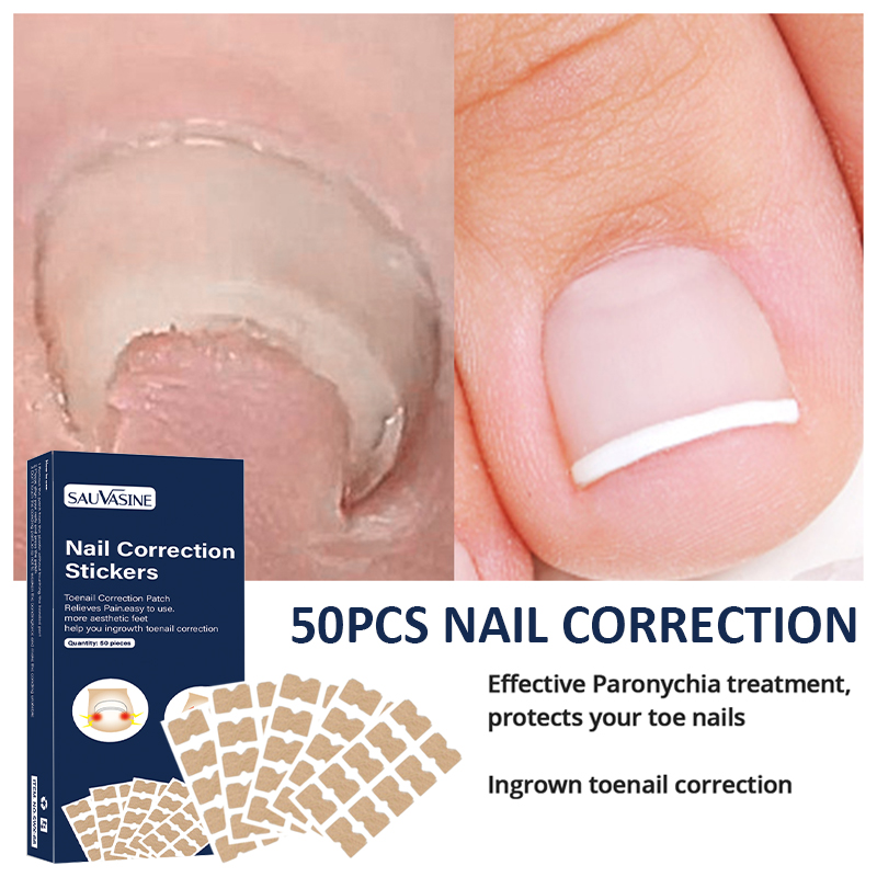 Best of 50pcs Nail Correction Stickers Ingrown Toenail Corrector Patches Waterproof Paronychia Treatment Recover Corrector Pedicure Tool Reviews & Tips