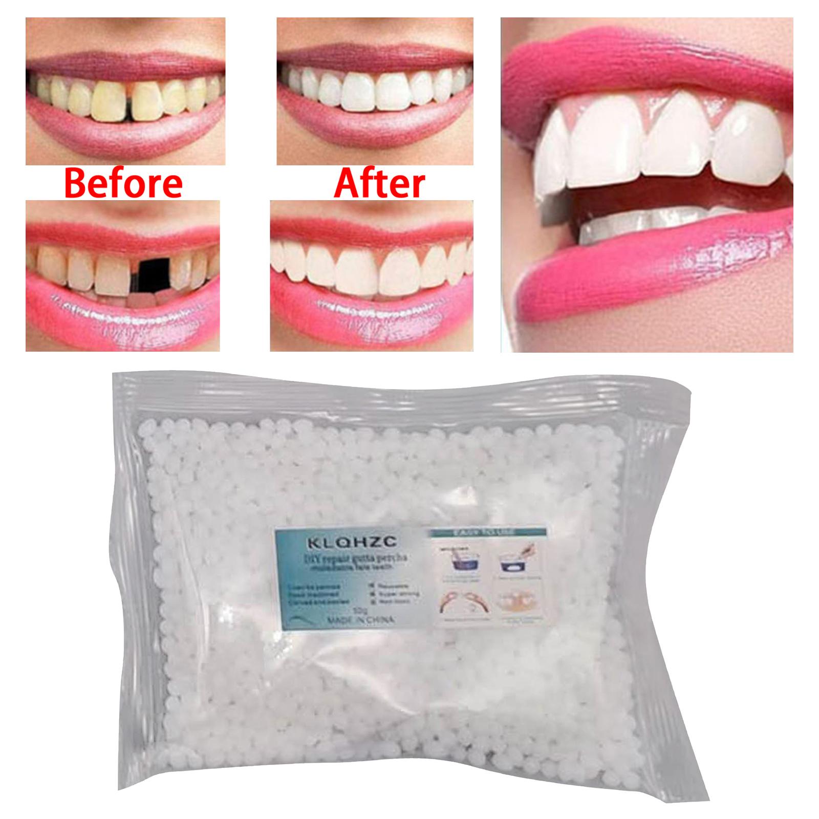 Teeth Repair Kit Teeth Veneers Fix The Missing Tooth Teaching Confident Smile Tooth Adhesive Oral Care Easy to Use Thermal Beads