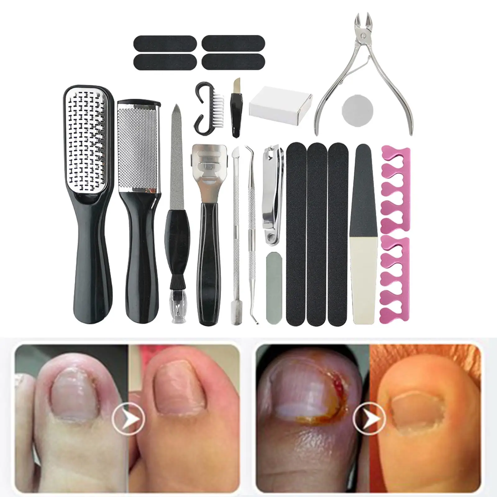 23Pcs Manicure Foot  Callus Remover  Tool for Cracked Rough  Salon Home for Men Women with Storage Case