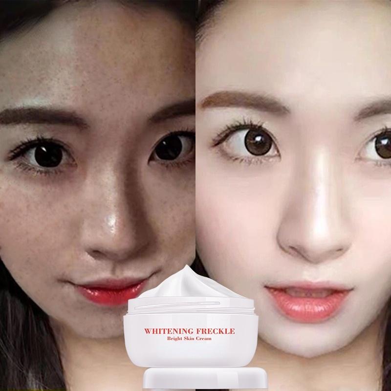 Best of Bright Skin Cream Powerful Whitening Freckle Cream Remove Melasma Acne Spots Pigment Melanin Dark Spots Face Care Cream Skin Reviews & Tips