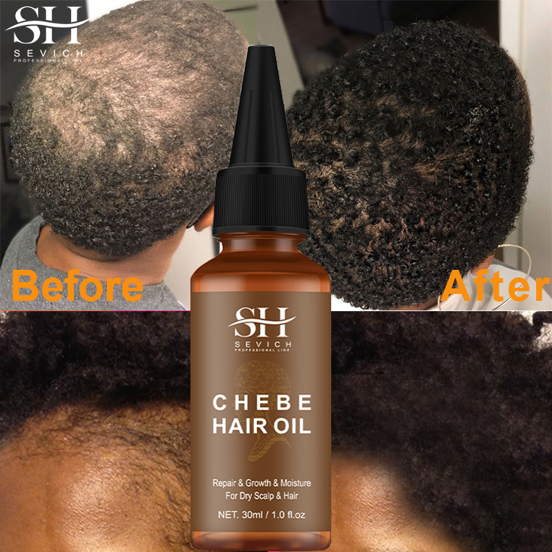 Best of Crazy Hair Growth Essencel Oil Africa Traction Alopecia Chebe Powder Hair Thicken Oil Hair Loss Treatment Hair Fast Regrow 30ml Reviews & Tips