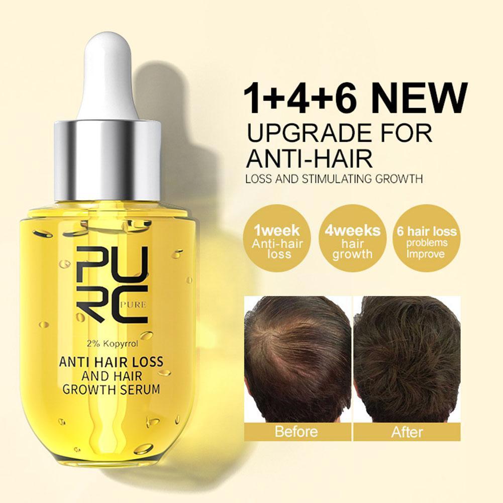 Best of PURC Products Ginger Serums Polygonum Multiflorum Hair Loss Treatment Hair Care Beauty Health For Men Women Q5T5 Reviews & Tips