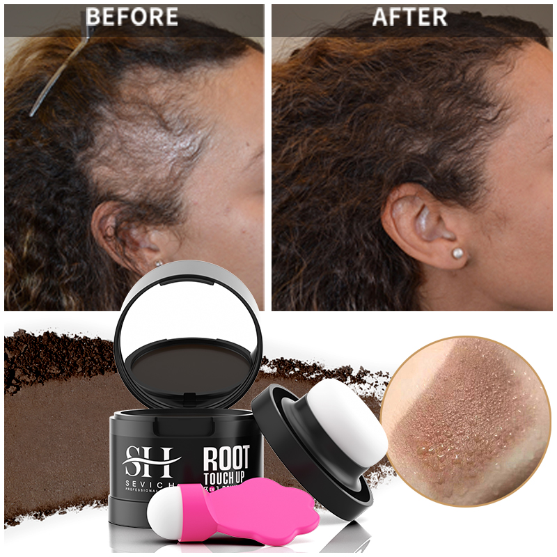 Best of 2024 Sevich New Hairline Powder 4g Black Root Cover Up Instant Waterproof Hair Line Shadow Powder Hair Concealer Coverage Makeup Reviews & Tips