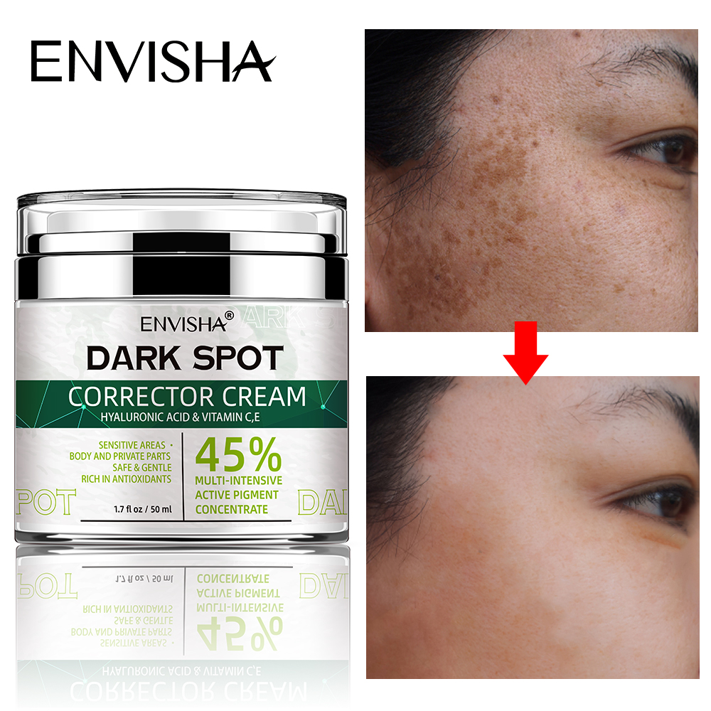 Best of ENVISHA Face Skin Care Whitening Freckle Cream Remove Melasma Dark Spots Melanin Brighten Anti-Aging Lightening Shrink Pores Reviews & Tips