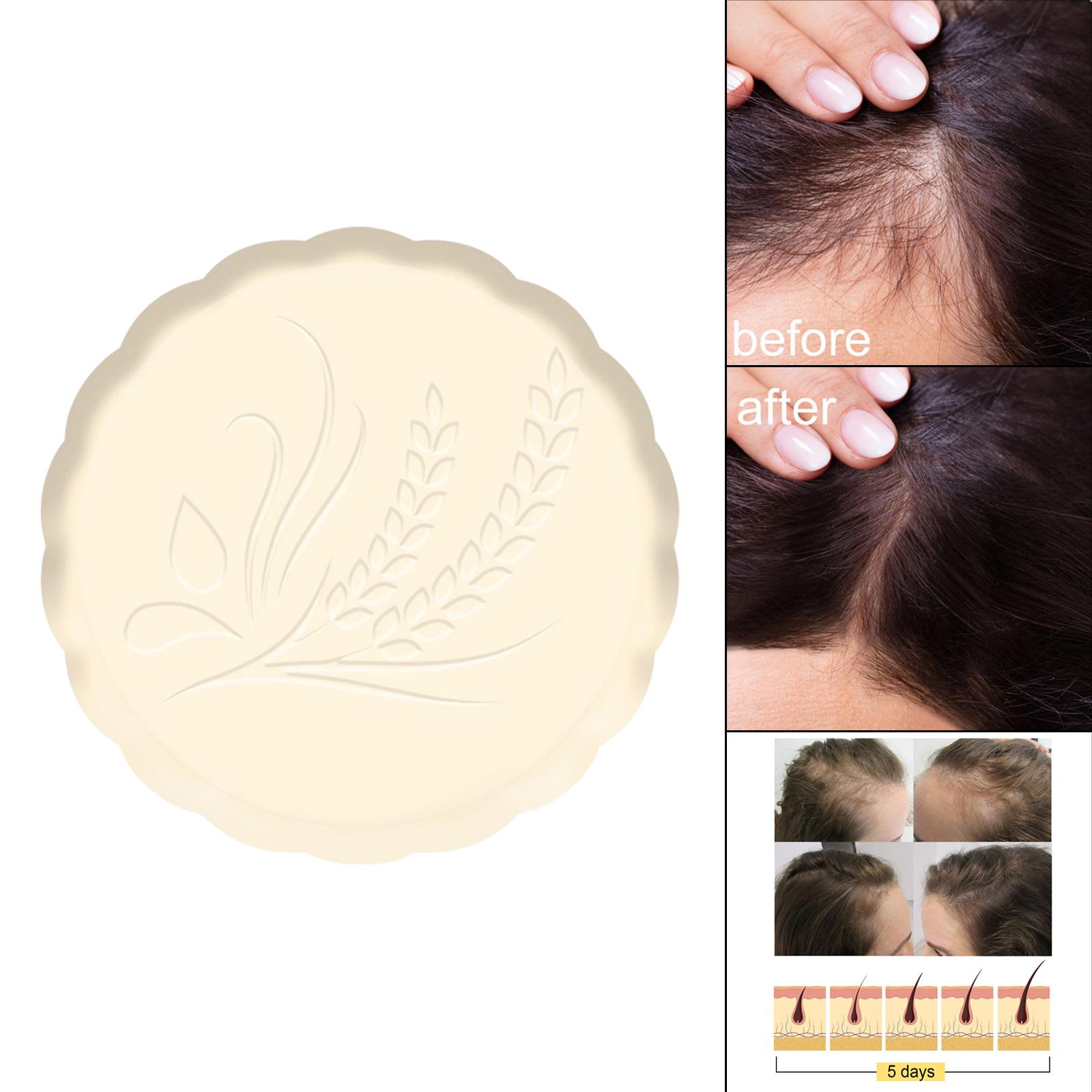 Rice Shampoo Bar Moisturizing Eco Friendly Solid Shampoo Soap for Hair Growth Promotes Healthy Hair Growth Dry Damaged Hair Girl
