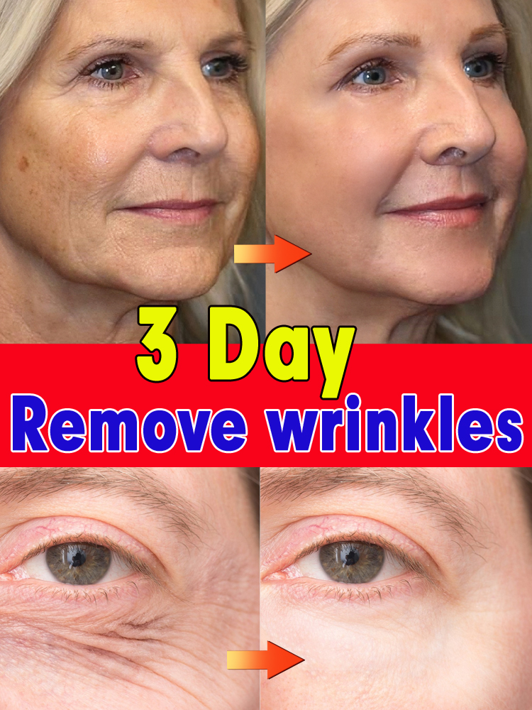 Best of Anti-wrinkle Facial Serum Remove Facial Eye Wrinkles Anti Aging Reviews & Tips