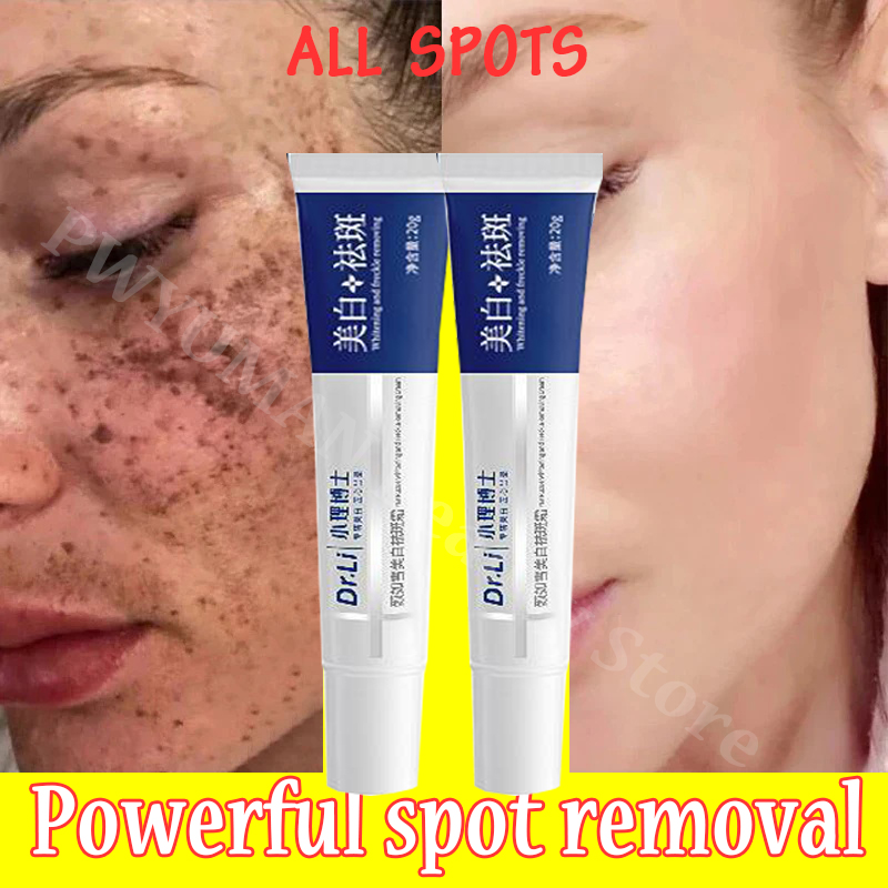 Best of Nicotinamide Whitening Cream Lighten Freckles Melasma Treatment Pigmentation Ointment Dark Spot Remove Brighten Korean Skin Care Reviews & Tips