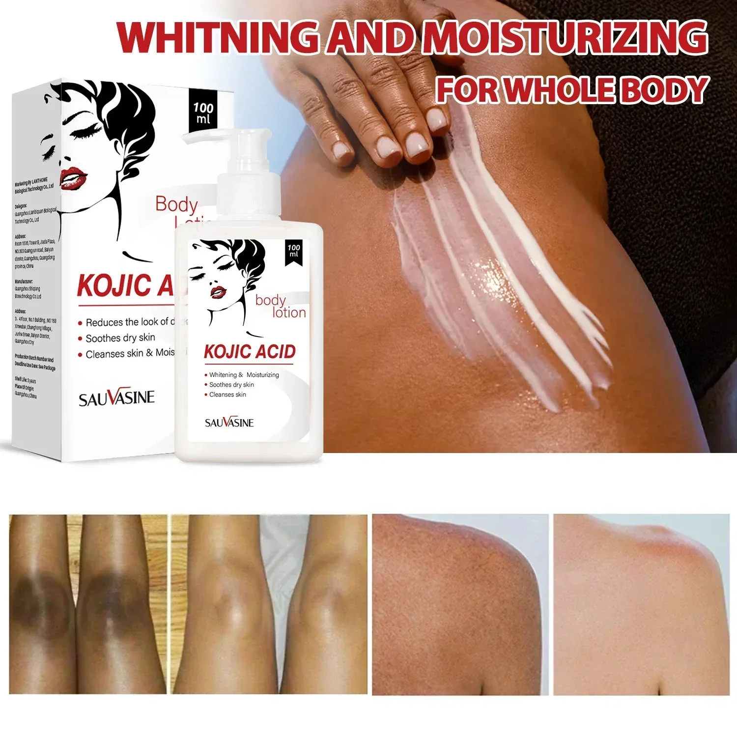 Best of 100ml Kojic Acid Whitening Body Lotion Skin Whitening Cream Acne Dark Spots Remover Moisturizing Lightening Skin Care Products Reviews & Tips