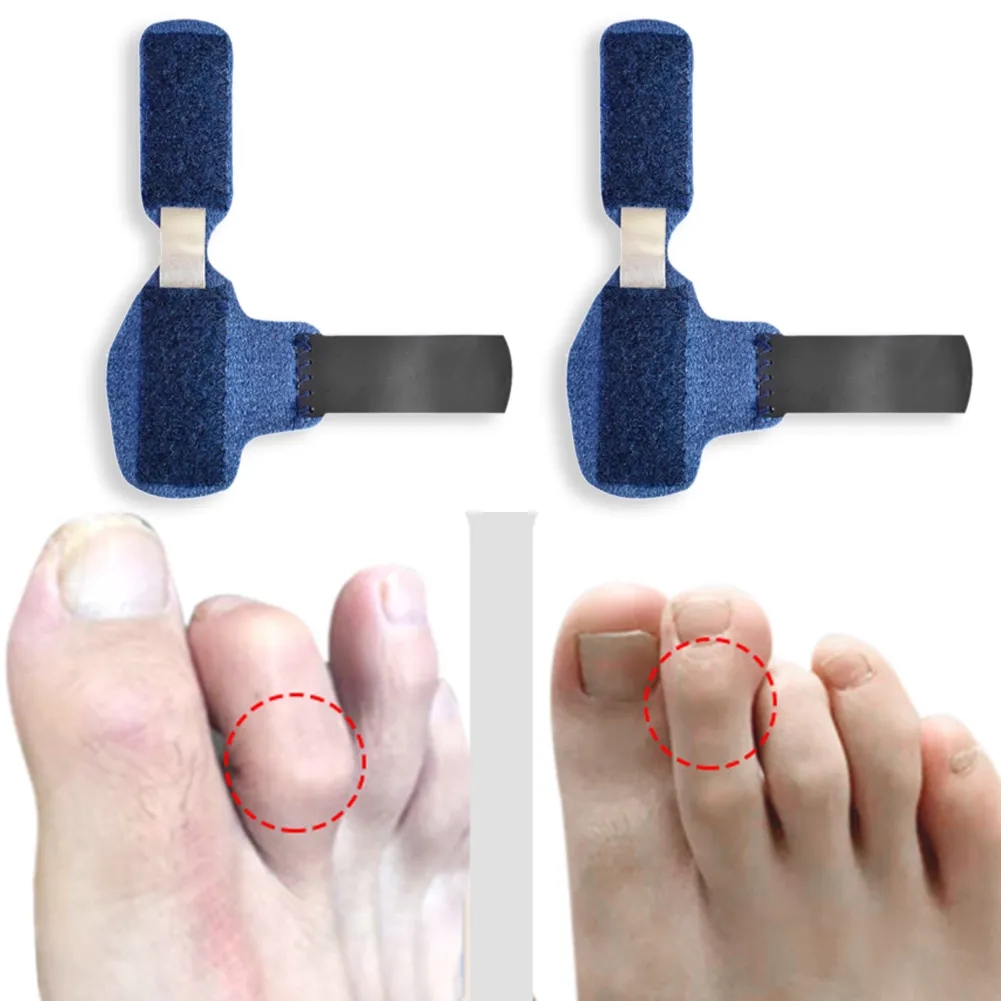 Best of 1Pcs Toe Splint Straightener Hammer Separator Corrector Crooked Fingers Claw Stabilizer Support Feet Care Corrector Pain Relief Reviews & Tips