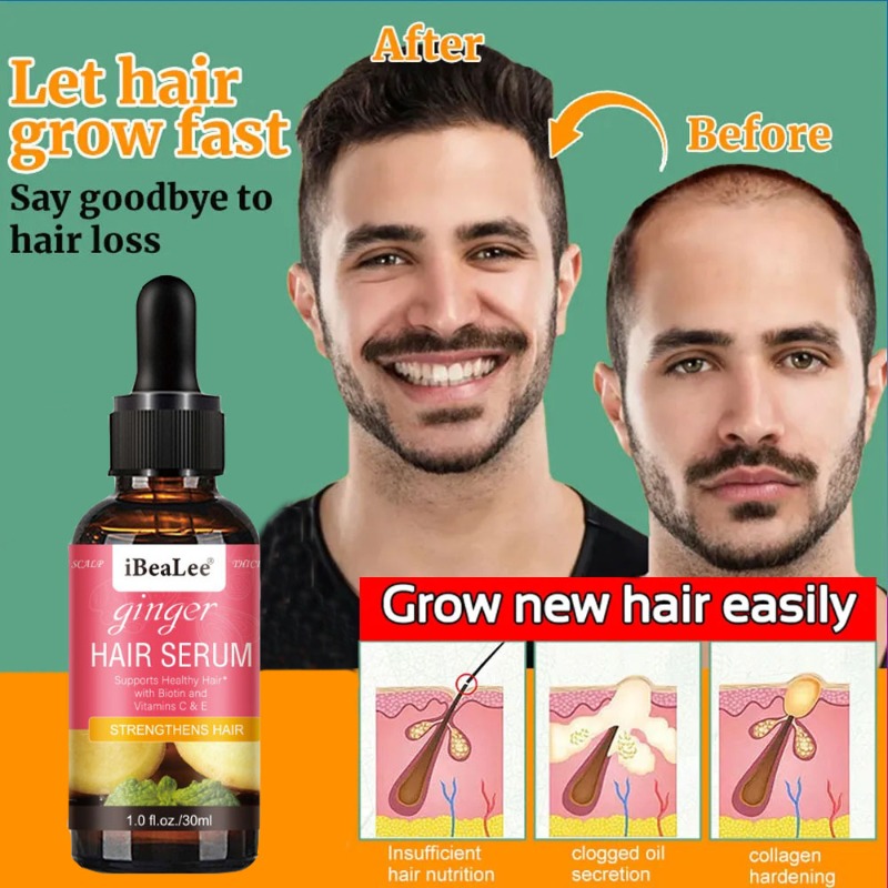 Best of Fast Hair Growth Oil Hair Regrowth Serum Hair Thinning Treatment Hair Growth Liquid Anti-Hair Scalp Treatment Baldness Care Oils Reviews & Tips