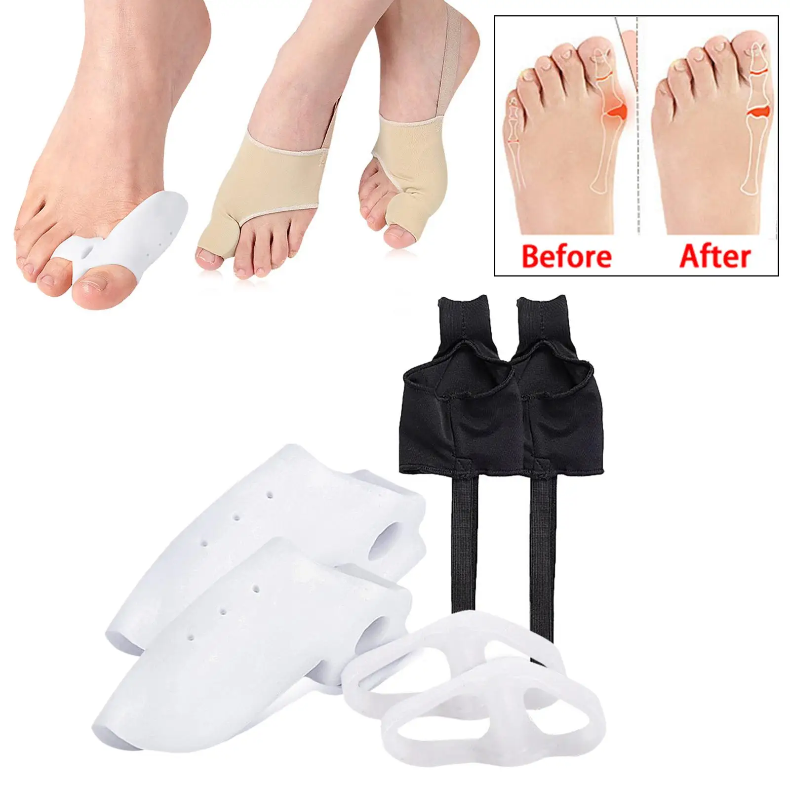 Bunion Corrector Kit Toe Splitter Toe Straightener Improves Toe Realignment Bunion Pads Sleeves Brace