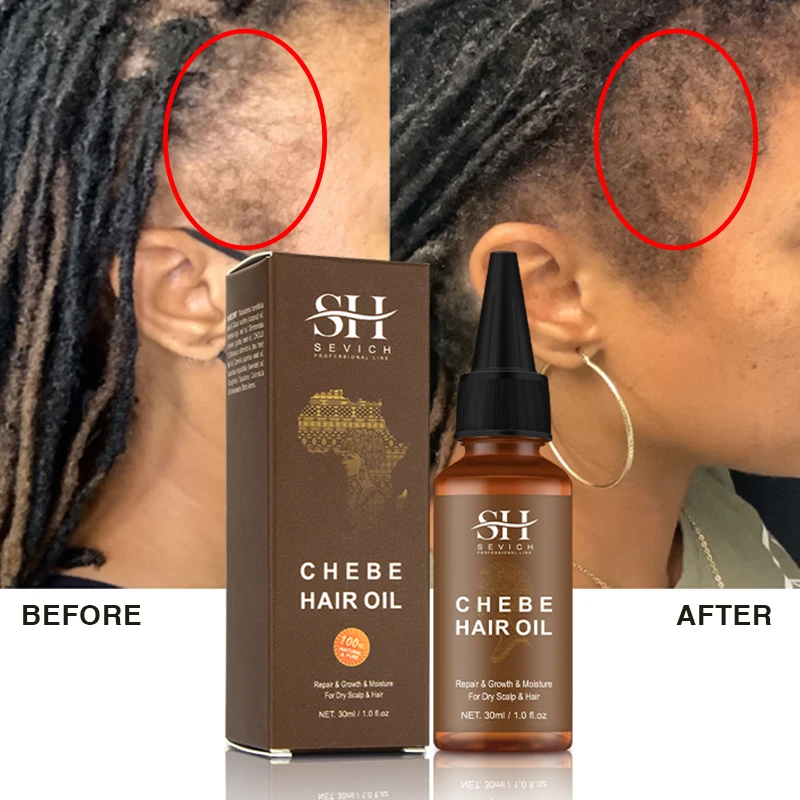 Best of Africa Fast Hair Growth Oil Chebe Oil Traction Alopecia Treatment Products Repair Damage Anti-Hair Loss Hair Care Essential Oils Reviews & Tips