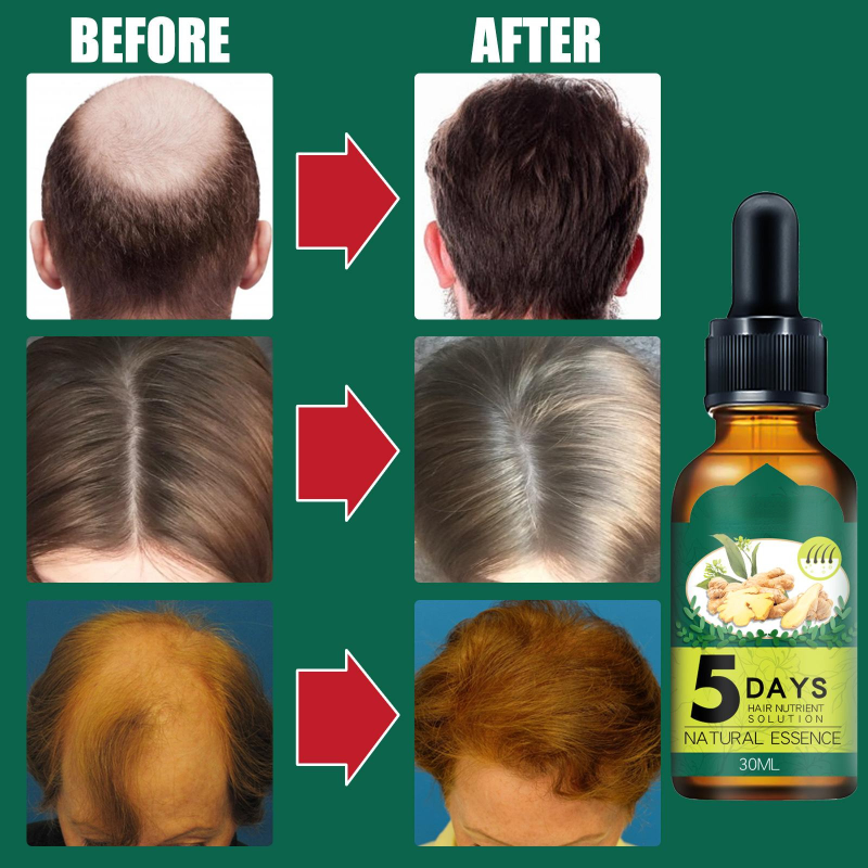 Best of Ginger Hair Growth Essence Oil Nutrient Fast Growing Hair Prevent Hair Loss Oil Scalp Treatment Oil For Men Women Hair Care Reviews & Tips - Image 3