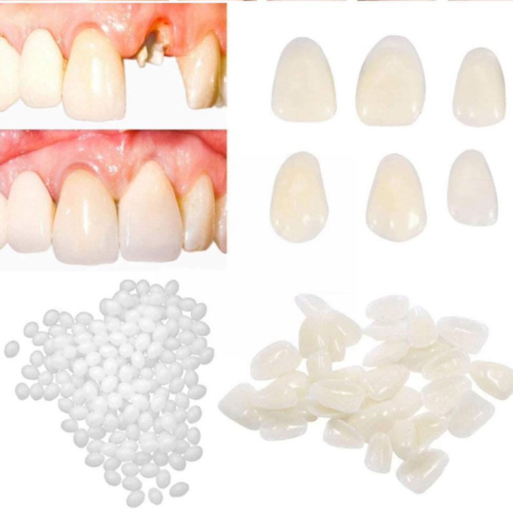 Best of Resin 5g / 10g / 15g / 20g Temporary Tooth Repair Kit Teeth Adhesive Whitening Beauty Gaps Denture Tooth Glue FalseTeeth Teeth So N6P2 Reviews & Tips