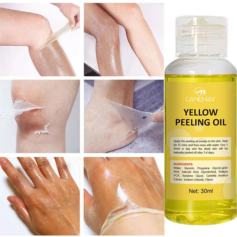 Best of Yellow Peeling Oil Exfoliating Bleaching Dark Skin Spots Knee Finger Remove Dead Skin Melanin Whitening Brighten Body Skin Care Reviews & Tips